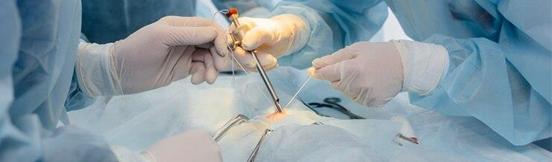 Laparoscopic Radical Nephrectomy 